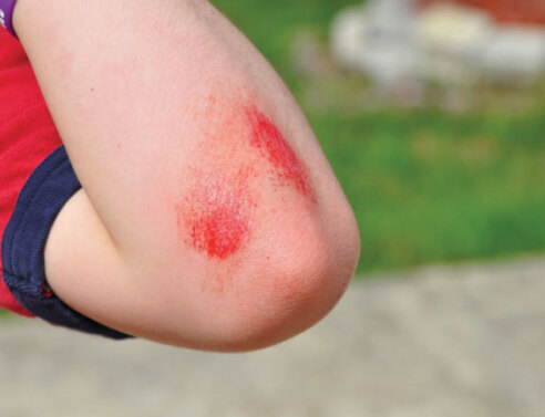 Μικρές πληγές, μεγάλοι μπελάδες