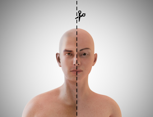 Αλλαγή φύλου άρπα κόλλα;