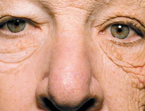 Γέρασε στο τιμόνι: Οδηγός νταλίκας παραμορφώθηκε από τον ήλιο (εικόνα)