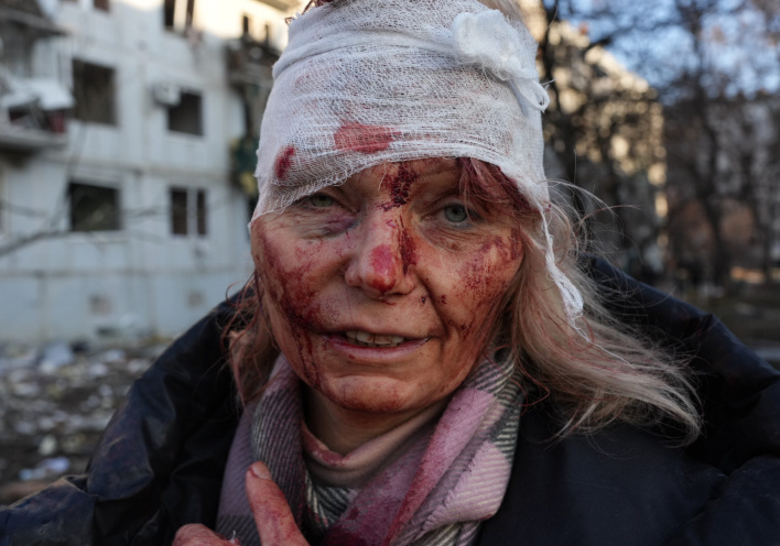 Ουκρανή, τραυματίας, πόλεμος