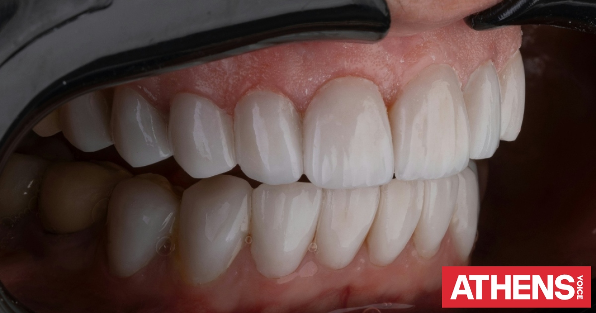 Έχασε τα δόντια, τη δουλειά και την υγεία της