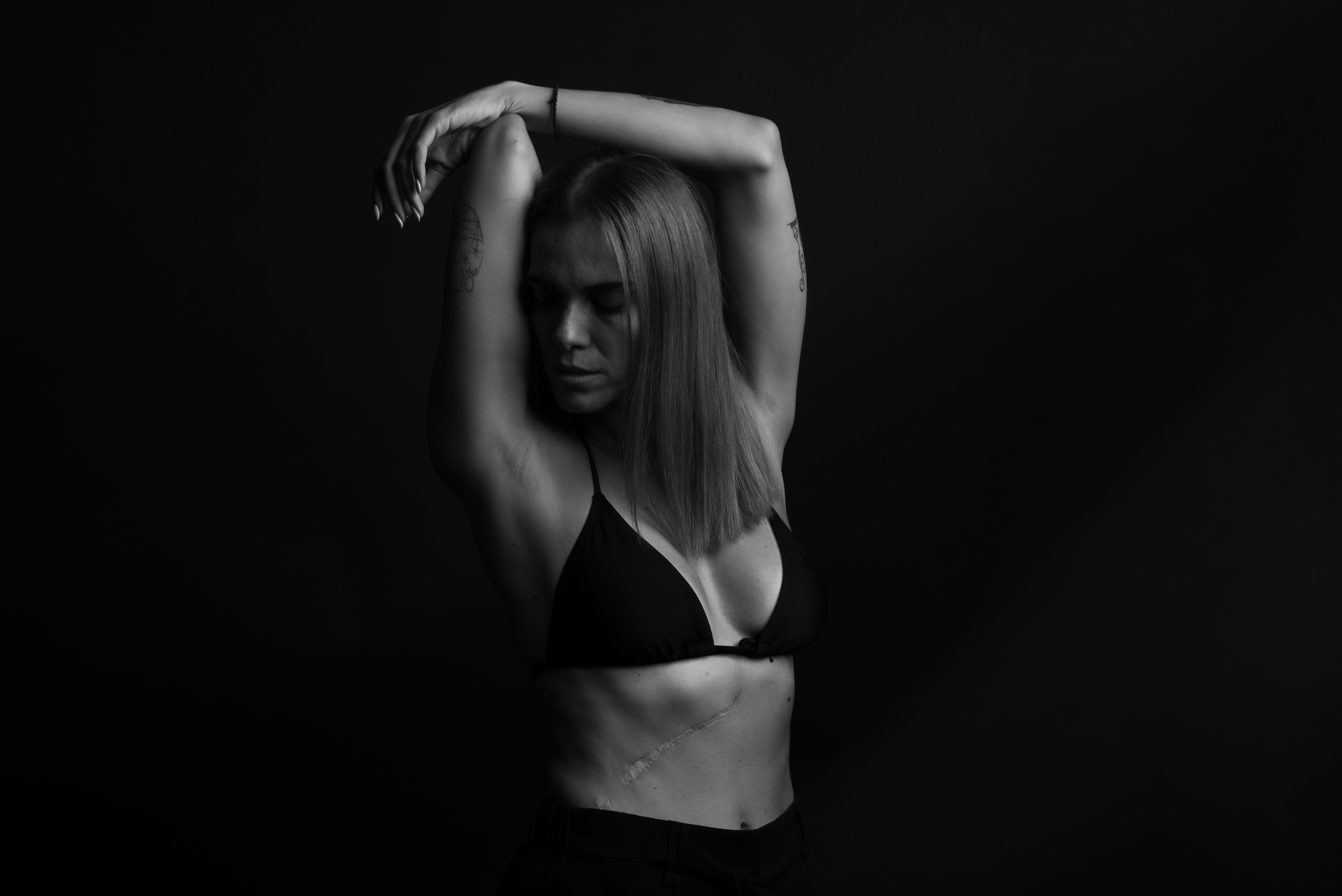 Ουλή από χολοπεπτική αναστόμωση