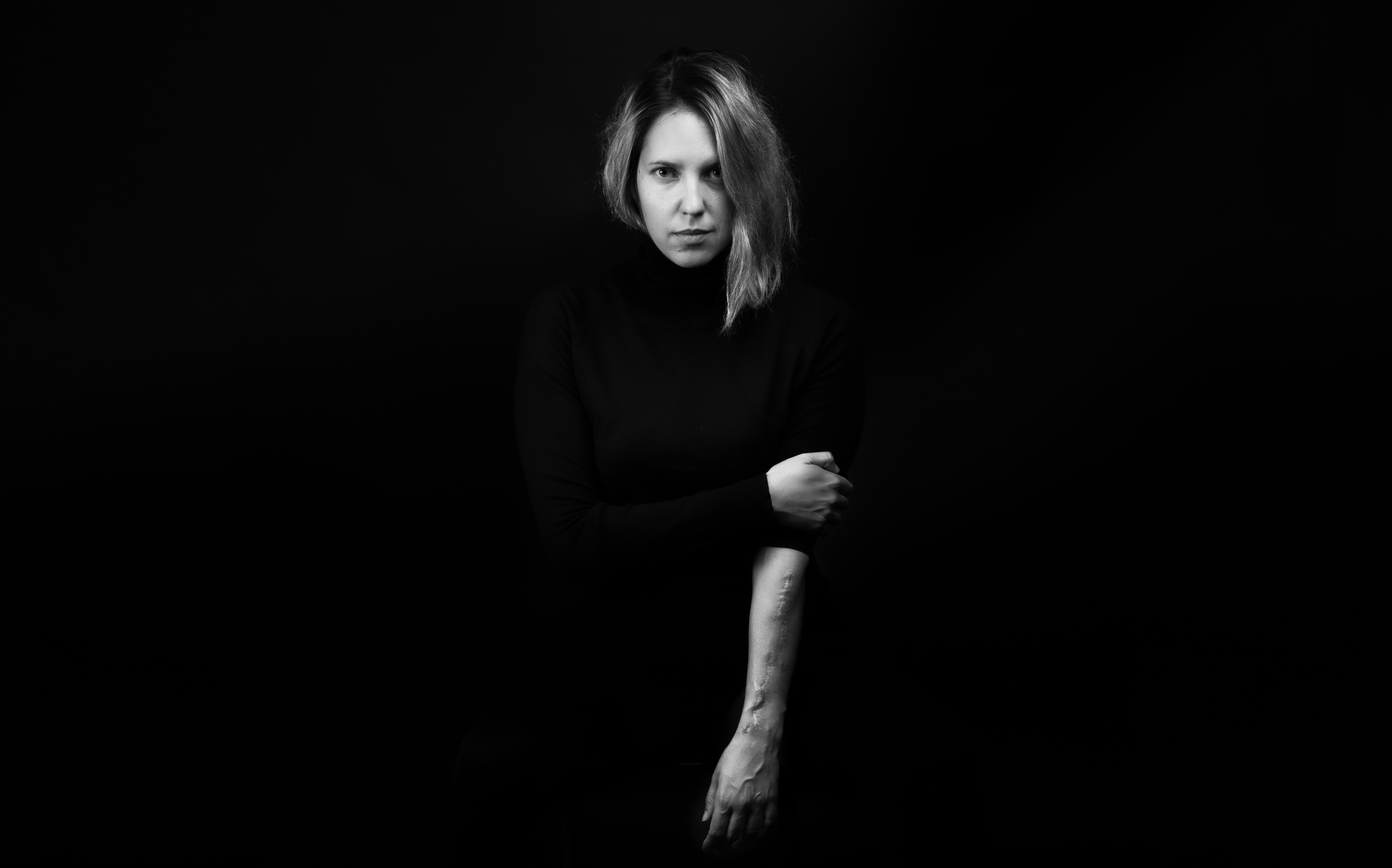 Ουλή από τριπλό συντριπτικό κάταγμα