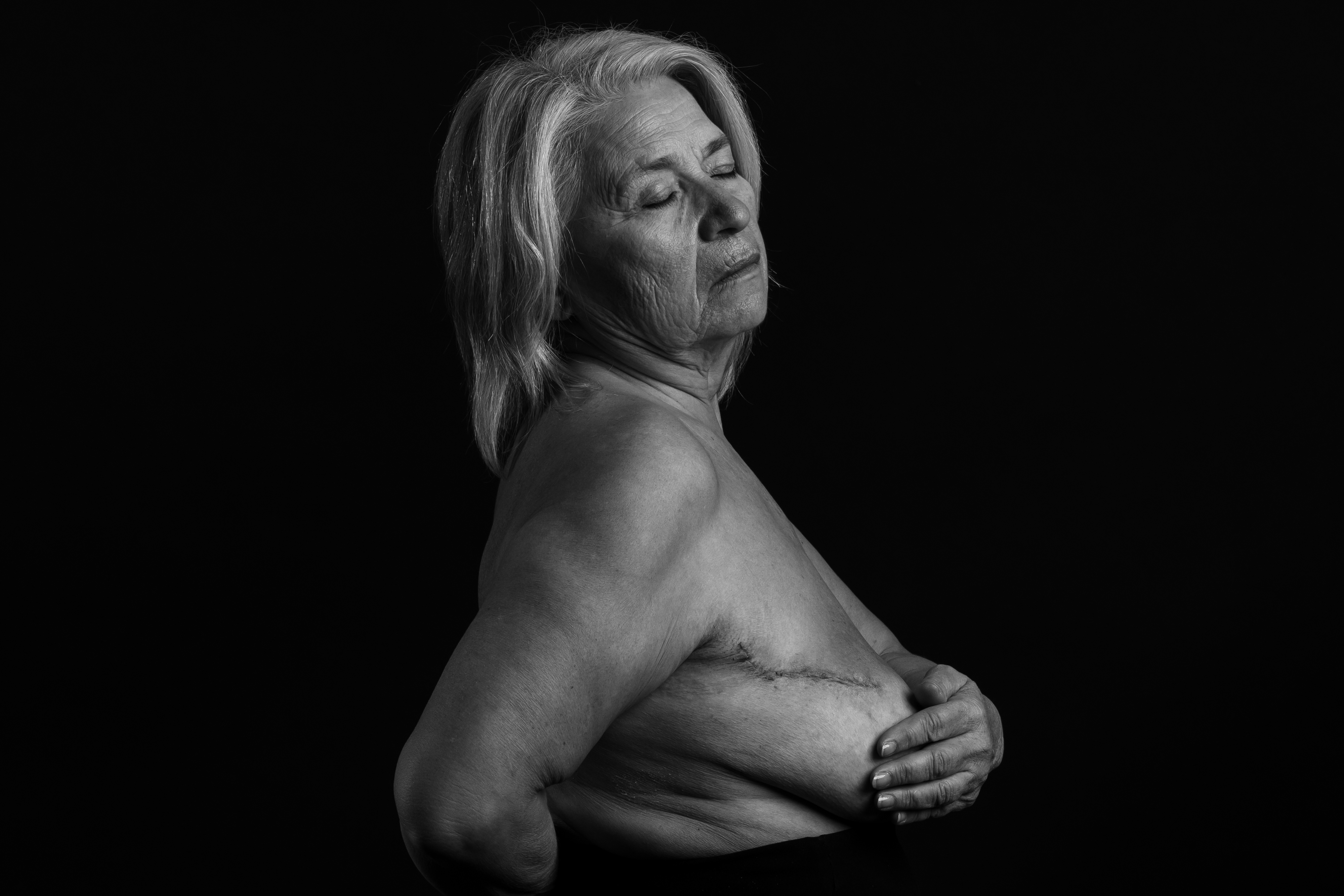 Ουλή από όγκο