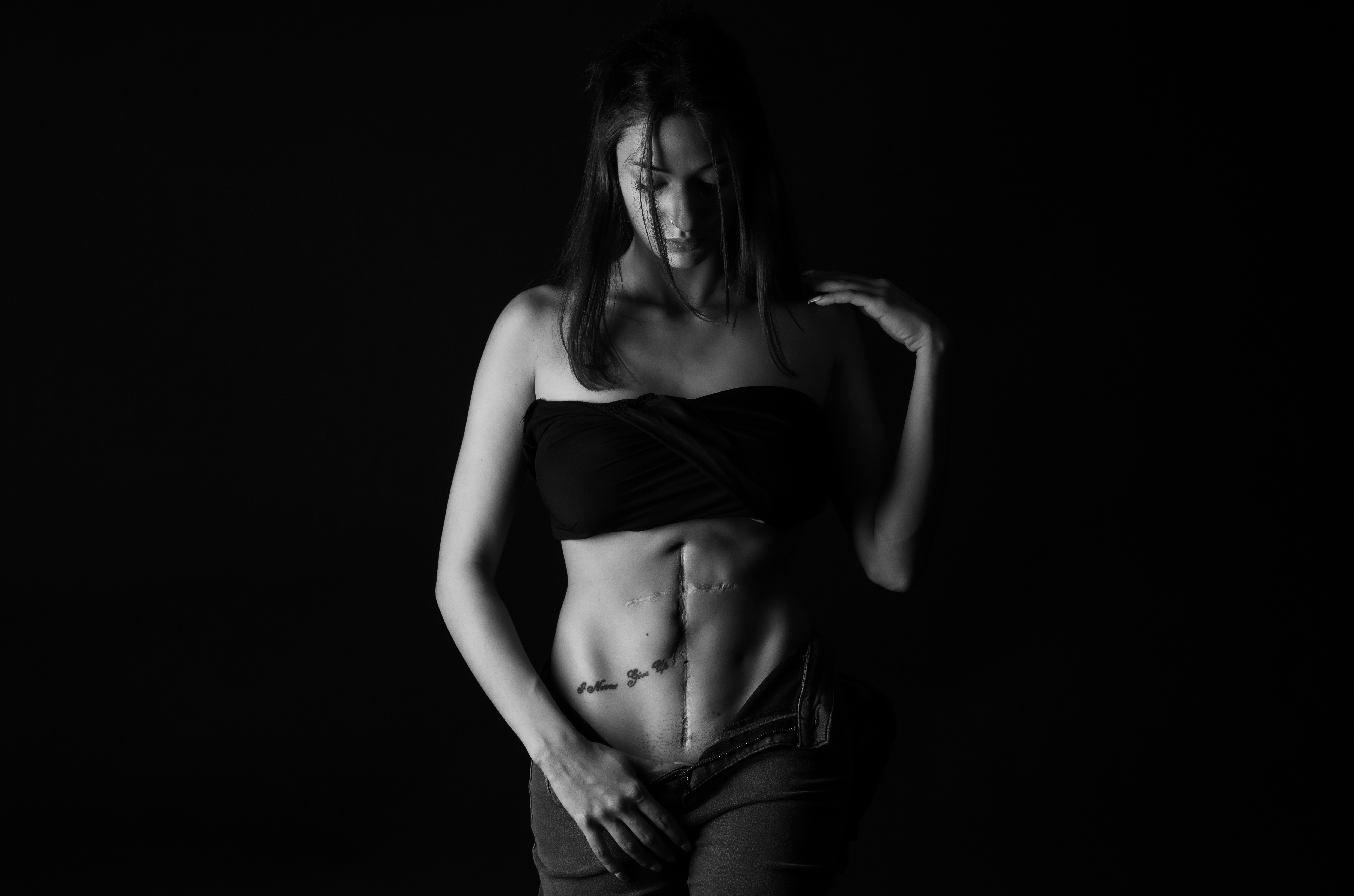 Ουλή από χειρουργείο