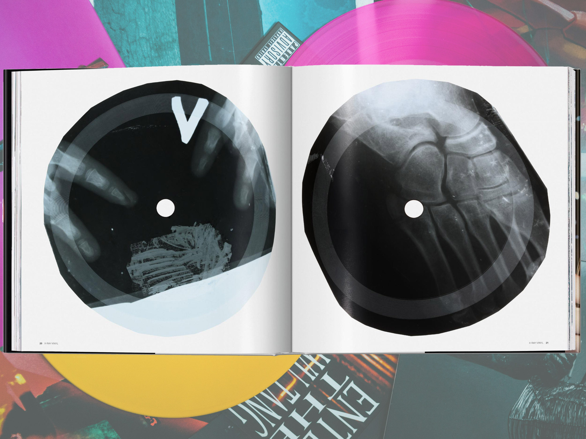 Extraordinary Records: X-RAY VINYL