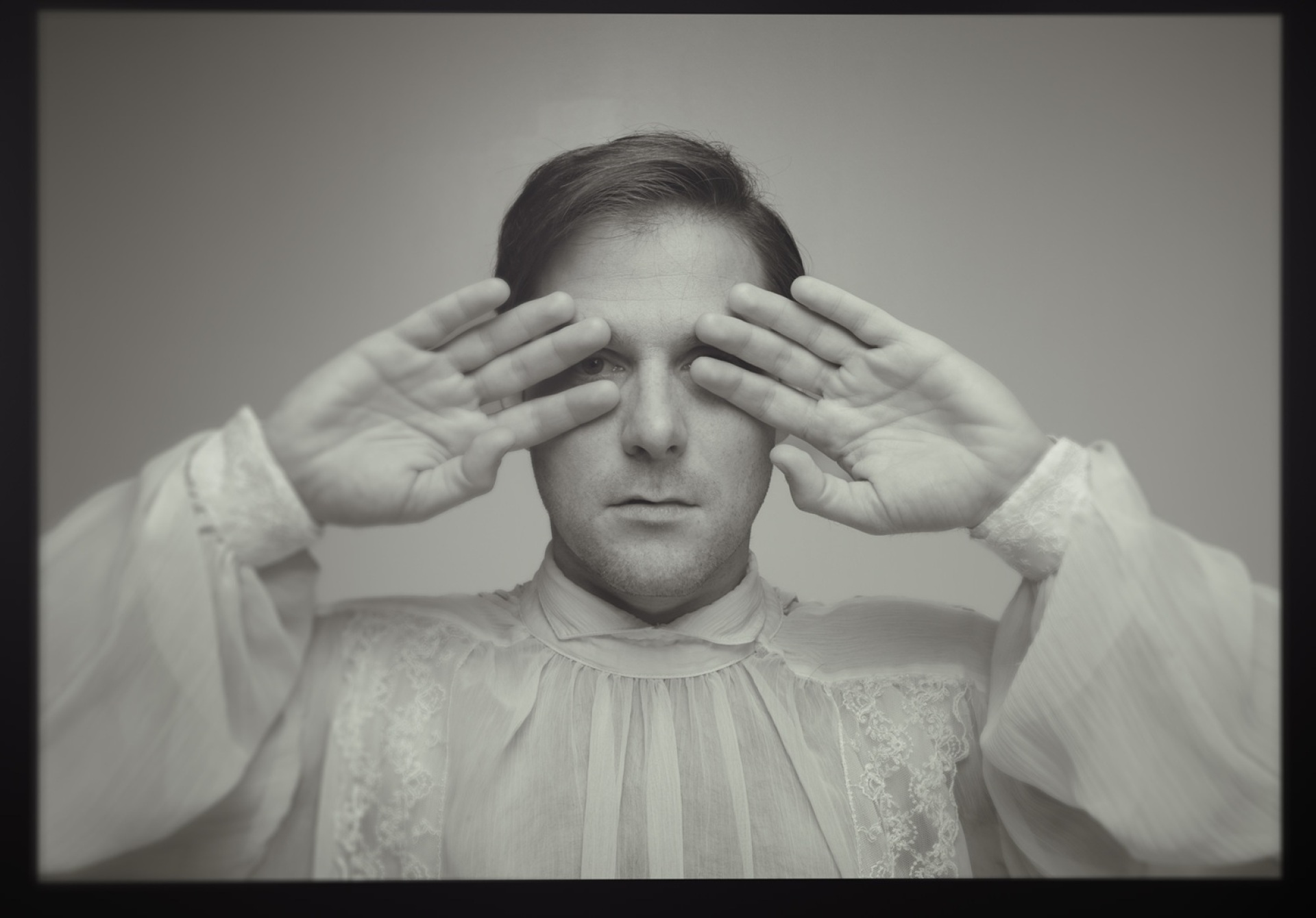 O Άλκης Μπακογιάννης υποδύεται τον Τζόζεφ Μέρικ στο «Ο άνθρωπος ελέφαντας- έτσι τον είπαν»