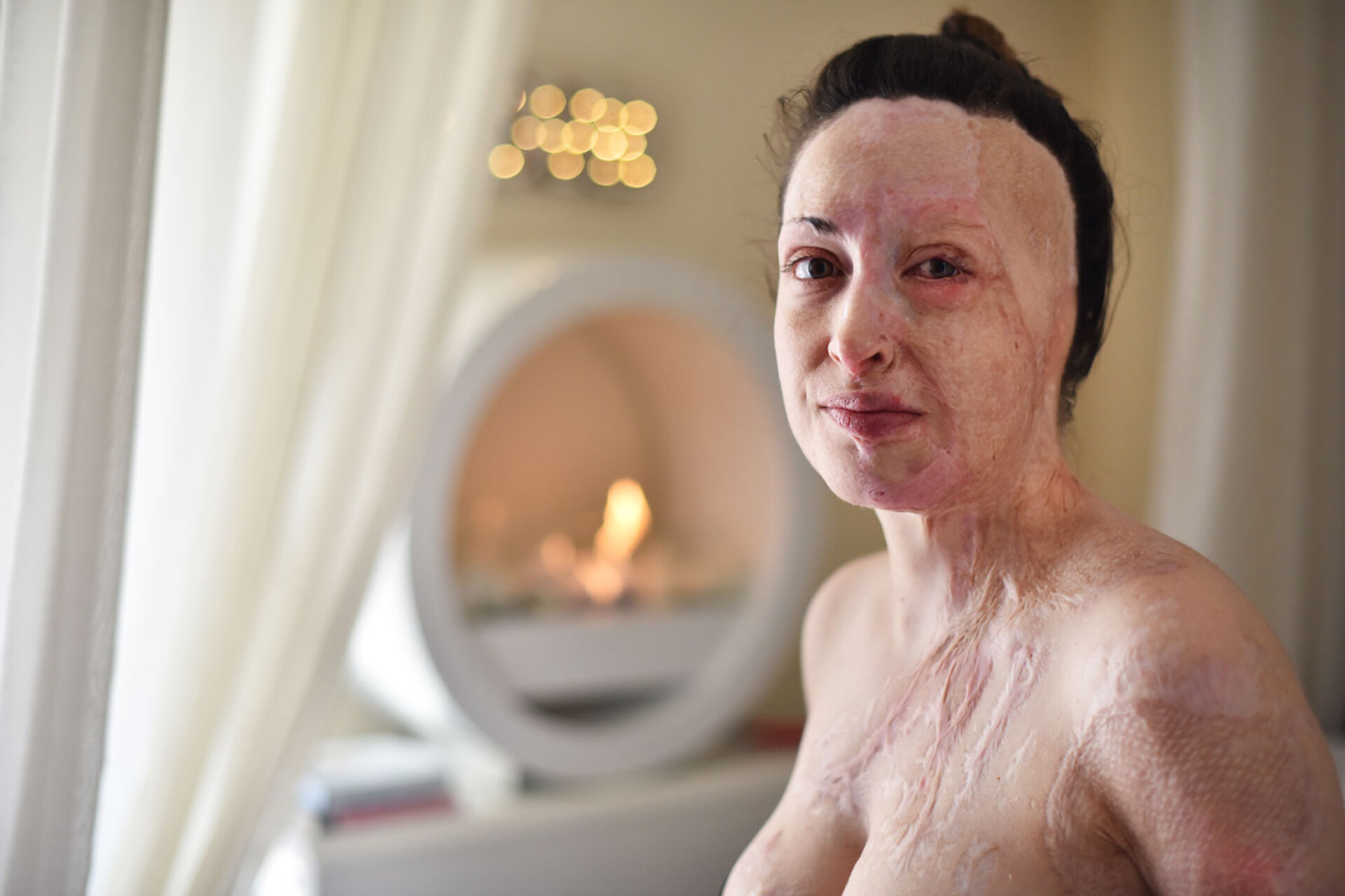 Ιωάννα Παλιοσπύρου, θύμα χημικής επίθεσης