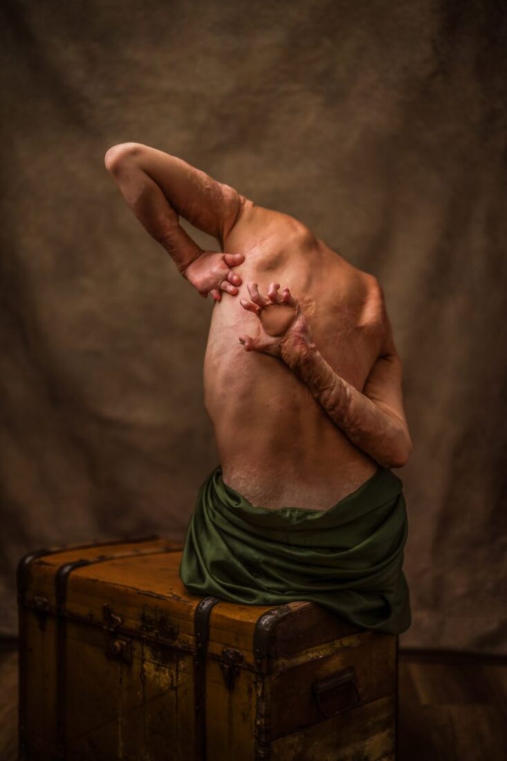 Salvia, «Έγκαυμα - Κάνοντας το «αόρατο» ορατό!» 