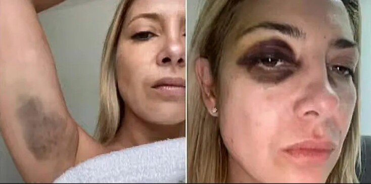 Η πρώην πρώτη κυρία της Αργεντινής, Fabiola YanezΗ πρώην πρώτη κυρία της Αργεντινής, Fabiola Yanez, καταγγέλλει τον Alberto Fernández για «σωματική και ψυχική βία», καταγγέλλει τον Alberto Fernández για «σωματική και ψυχική βία»