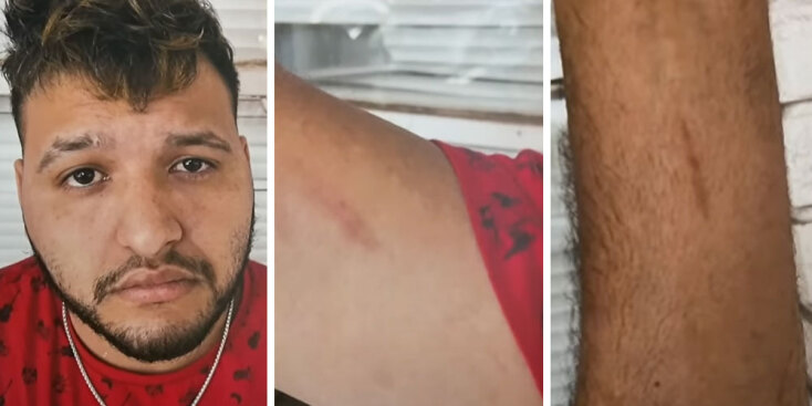 Οι γρατσουνιές στα χέρια του Χοσέ Αντόνιο Ιμπάρα