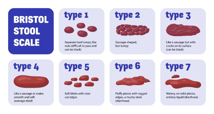 The Bristol Stool Chart