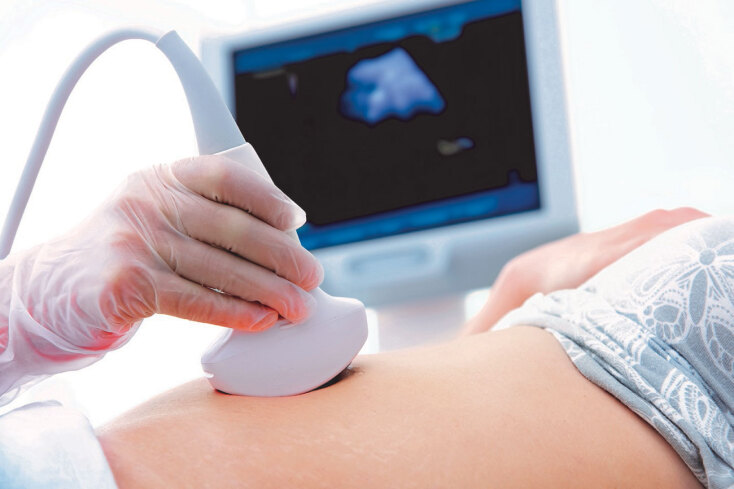 Γυναίκα πραγματοποιεί υπέρηχο κοιλίας