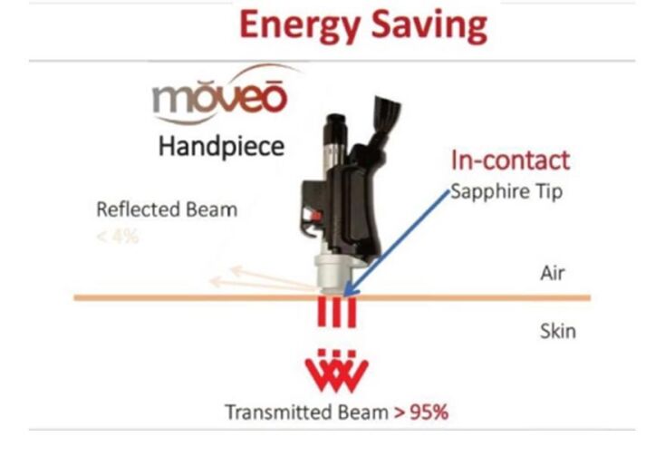 Aνάκλαση ενέργειας με χειρολαβή Αλεξανδρίτη εξ επαφής (moveo)