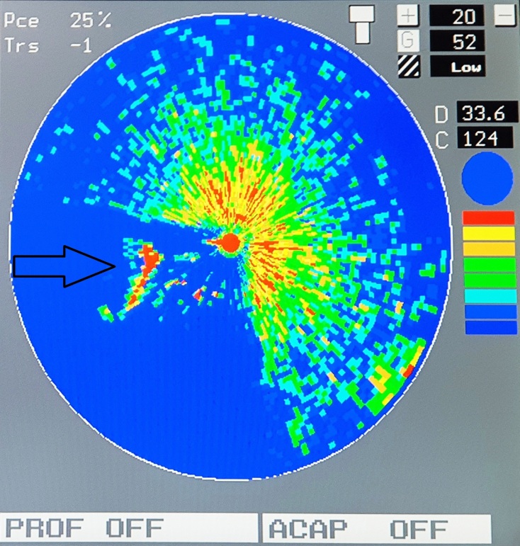 Πλοίο «Τρεις Ιεράρχαι»: Ηχοβολιστική απεικόνιση στρατιωτικού φορτηγού 6Χ6 τύπου G.M.C σε βάθος 87,2 μέτρων.