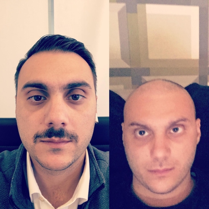 O Kωνσταντίνος Ράικος έζησε 10  μήνες σε καραντίνα ως καρκινοπαθής 