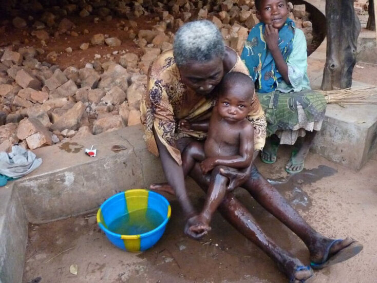 Κάρμε Κολ Καπντεβίλα, μια καταλανή γυναικολόγος στην Αφρική