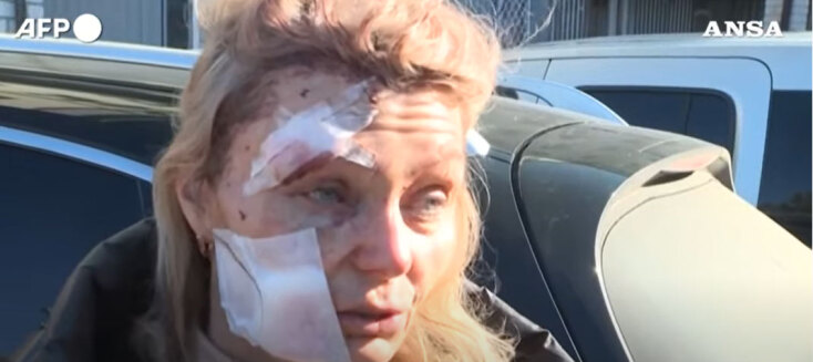 H τραυματισμένη δασκάλα στην Ουκρανία εξηγεί πώς γλίτωσε από θαύμα στον ρωσικό βομβαρδισμό