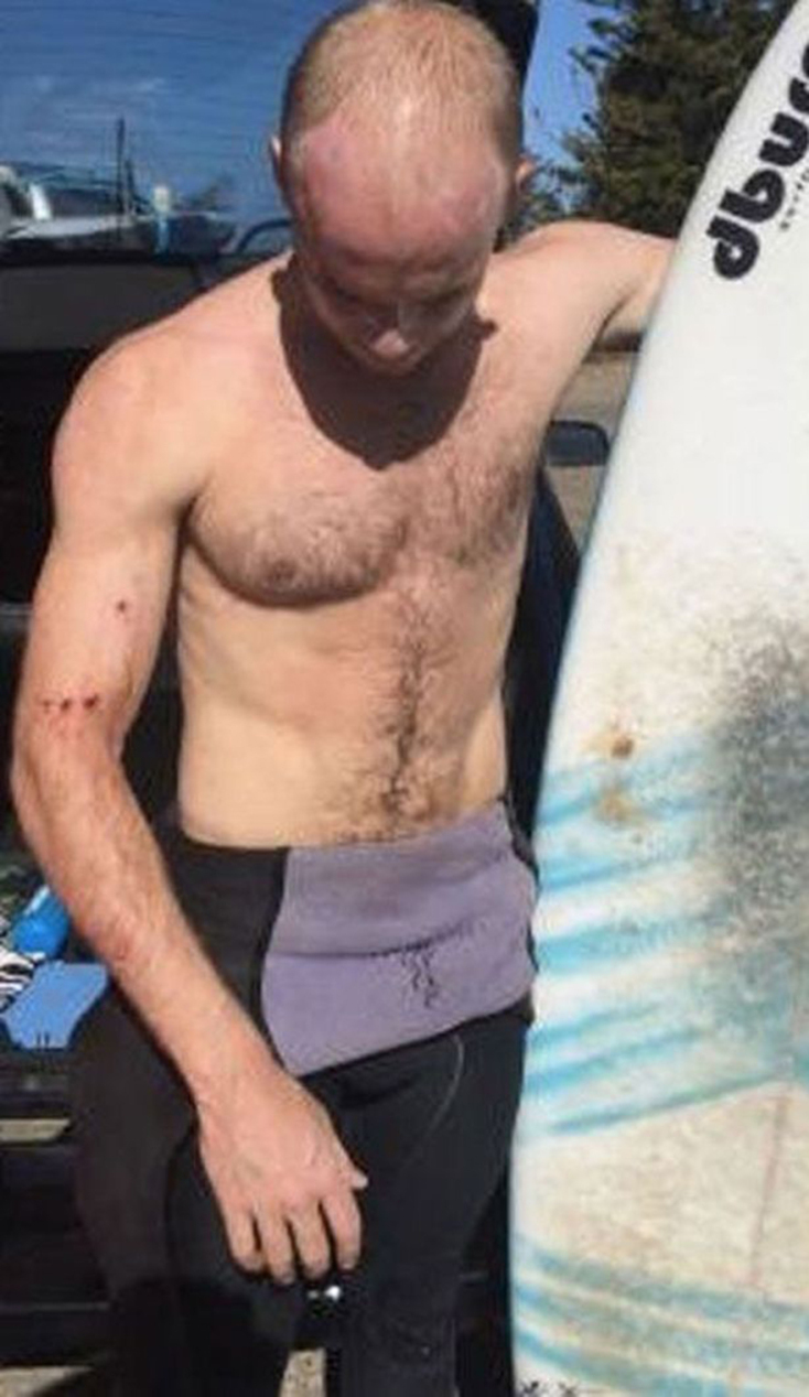 Τσάρλι Φράι