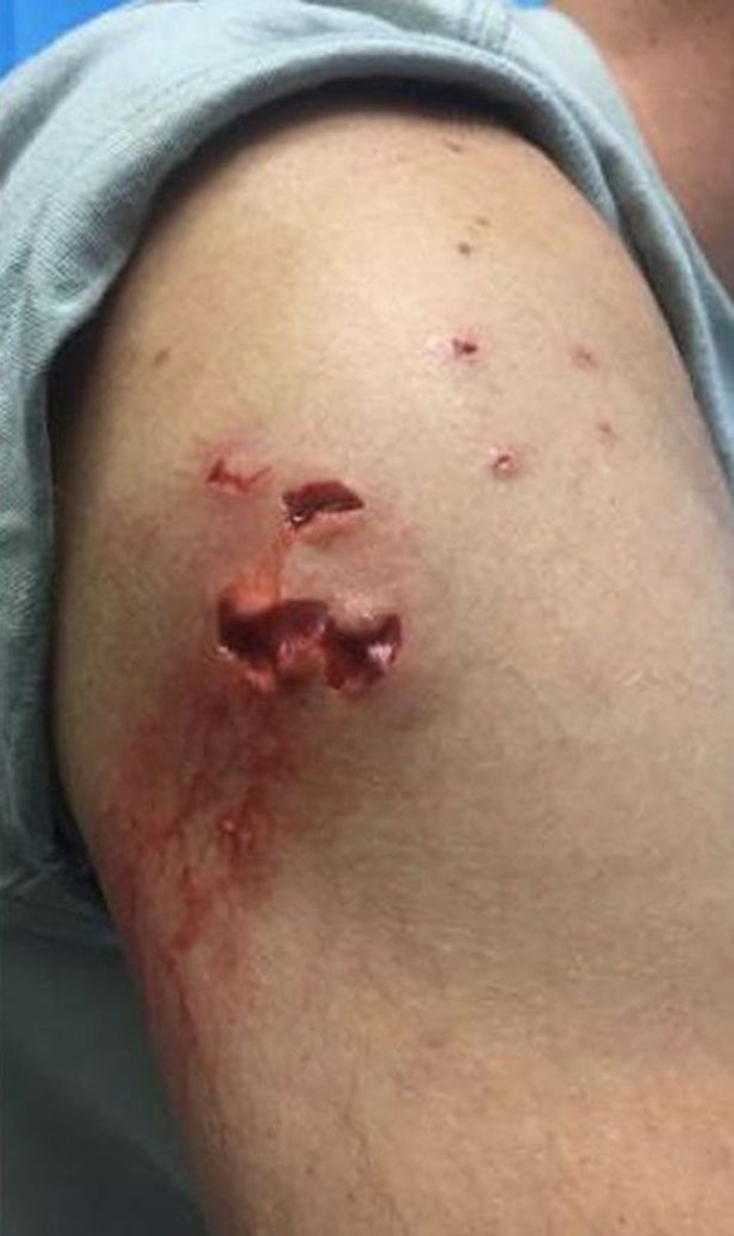 Τσάρλι Φράι