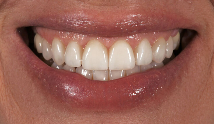 Η οδοντιατρική μέσα από τα pixels