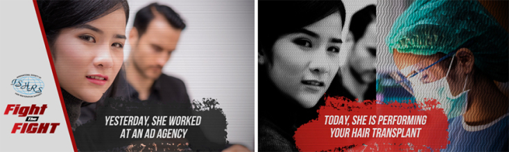 STOP από τη Διεθνή Εταιρεία Χειρουργικής Αποκατάστασης Τριχωτού (ISHRS)