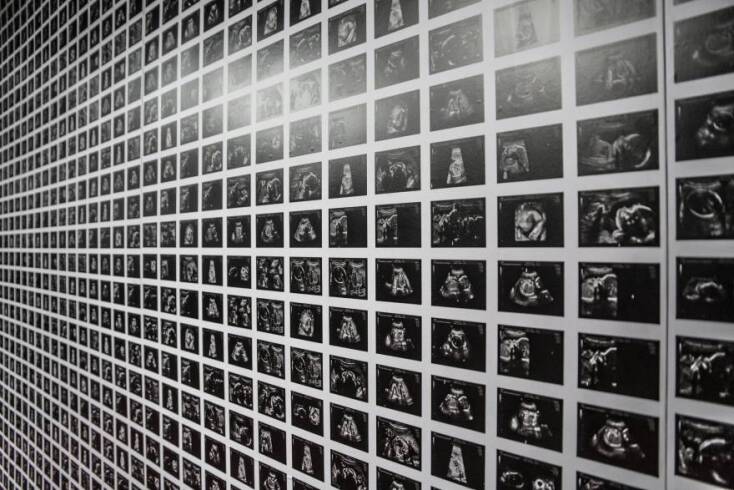 Στιγμιότυπο από τη θεατρική παράσταση «Κομμάτια μιας Γυναίκας»