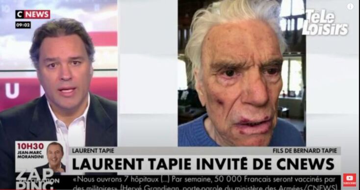 Σημάδια από τα χτυπήματα στο πρόσωπο του Μπερνάρ Ταπί