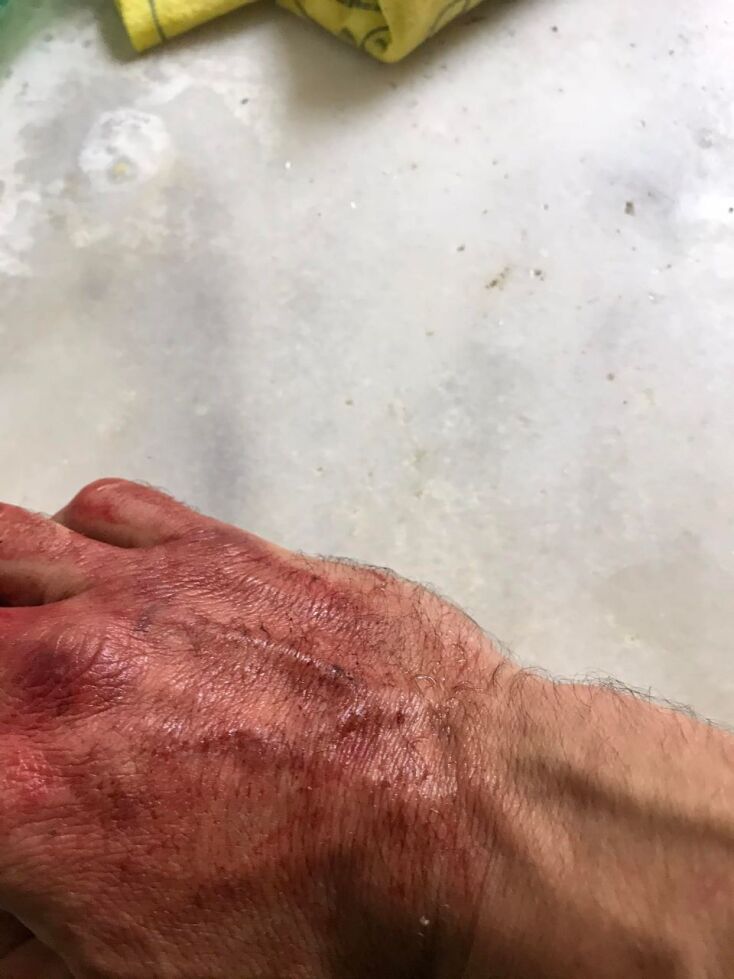 Επίθεση στον υπ. βουλευτή του ΣΥΡΙΖΑ Κώστα Μάρκου στην Πάτρα 