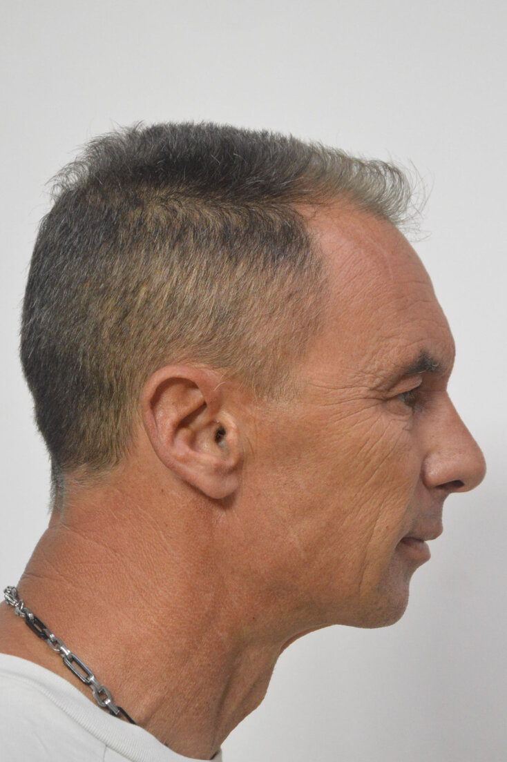 patra_apoplanisi_51xrono3