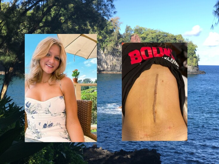 Νεαρή Αμερικανίδα έπεσε σε γκρεμό από ύψος 15 μέτρων όταν σκίστηκε η αιώρα της – Πώς επιβίωσε από την τρομακτική εμπειρία.