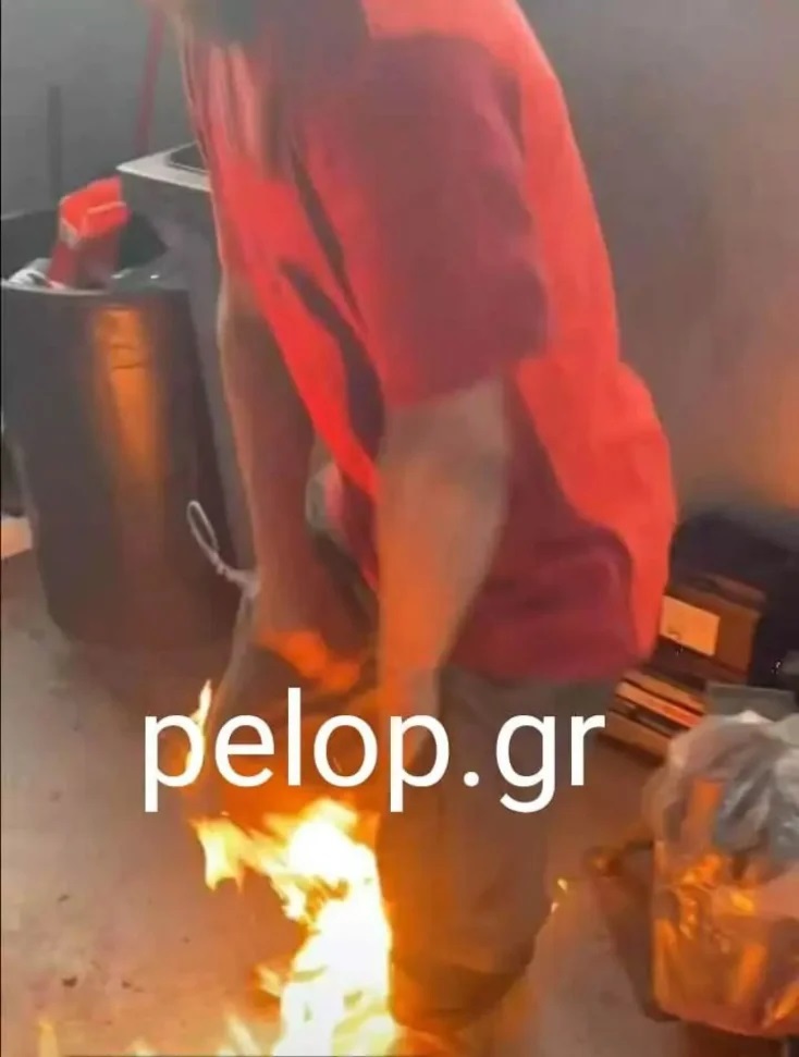 Έβαλαν φωτιά σε 35χρονο Ρομά που πήγε να τους πει τα κάλαντα