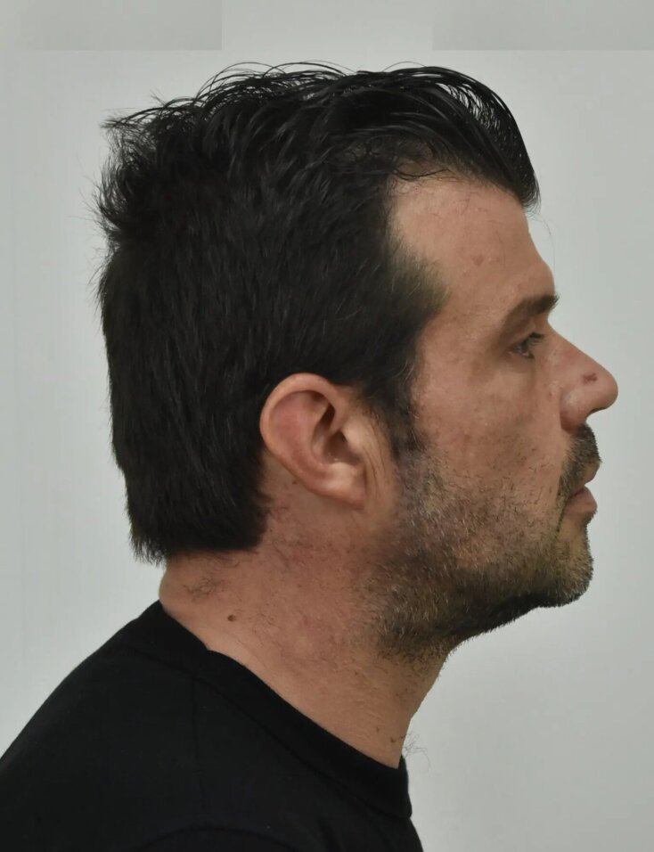 Αυτός είναι ο 41χρονος που έκλεβε κοσμηματοπωλεία στο Κολωνάκι (εικόνες)