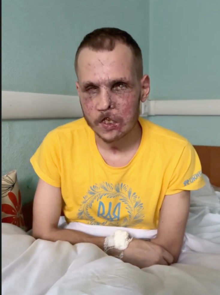 Ρωσο-ουκρανικός πόλεμος: Η μικρή ιστορία του Σεργκί, ήρωα πολέμου