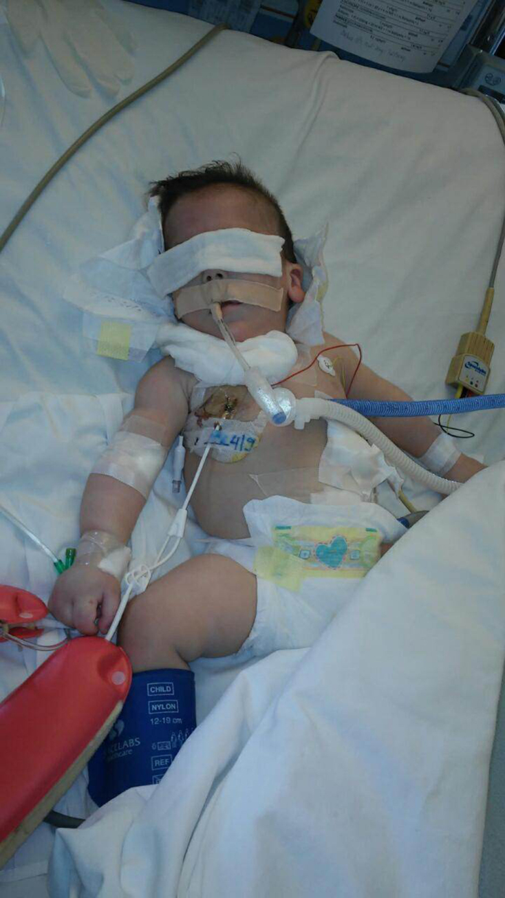 Μια μητέρα - φροντίστρια διηγείται την εμπειρία της: πώς απέκτησε και πώς έχασε το παιδί της που έπασχε από το σύνδρομο «Split Hand Foot Malformation 5»