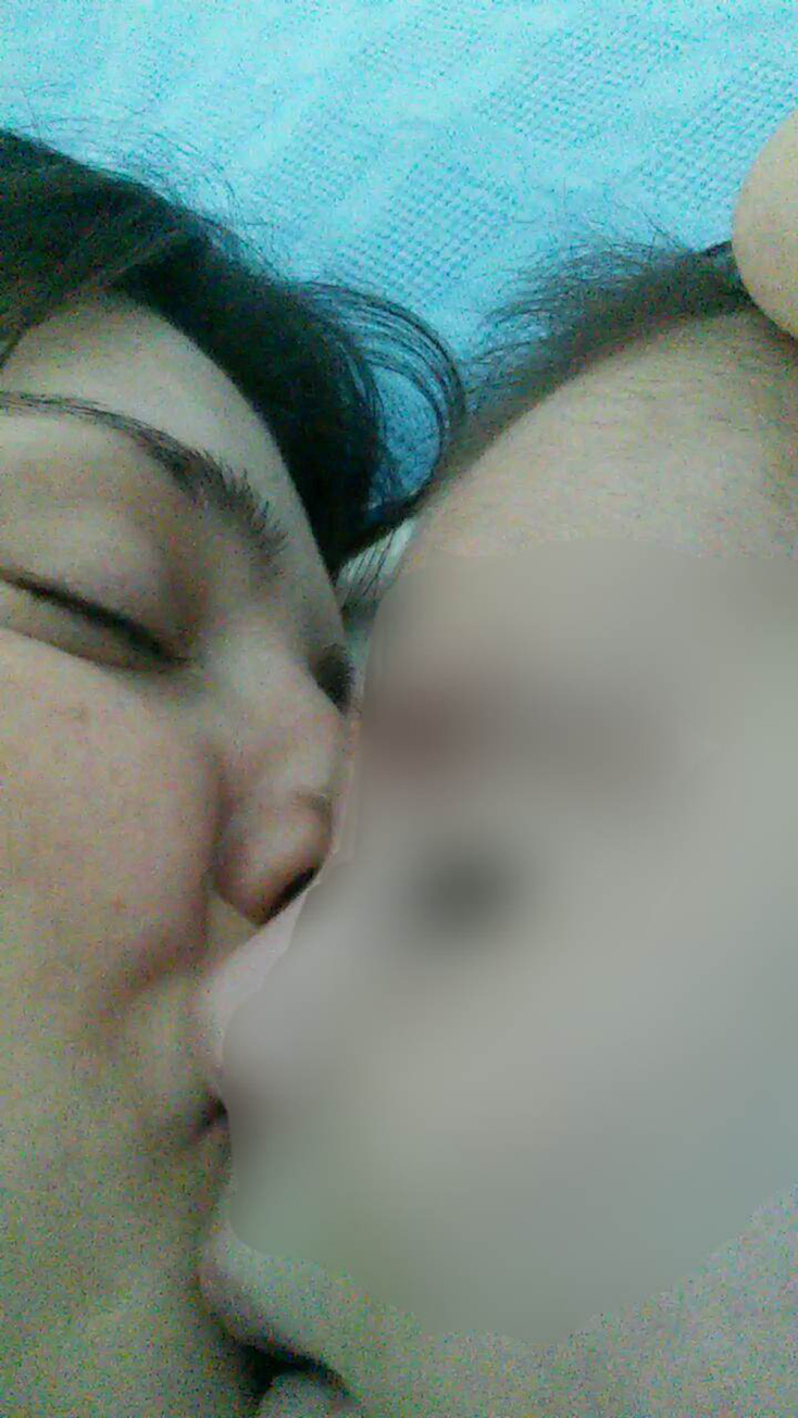 Μια μητέρα - φροντίστρια διηγείται την εμπειρία της: πώς απέκτησε και πώς έχασε το παιδί της που έπασχε από το σύνδρομο «Split Hand Foot Malformation 5»