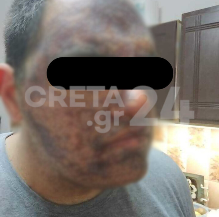 ergatiko-xenodoxeio-2