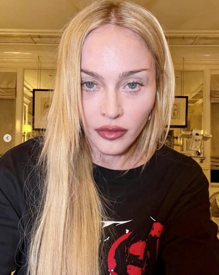 H Madonna επιστρέφει στο stage μετά τη σοβαρή βακτηριακή λοίμωξη