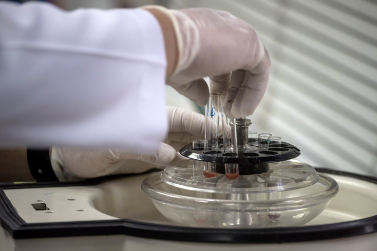 Πρότζεκτ Aθανασία: Μεταγγίσεις πλάσματος νέων σε δισεκατομμυριούχους της Σίλικον Βάλεϊ και η επιστημονική κούρσα για την αποτροπή της βιολογικής γήρανσης.