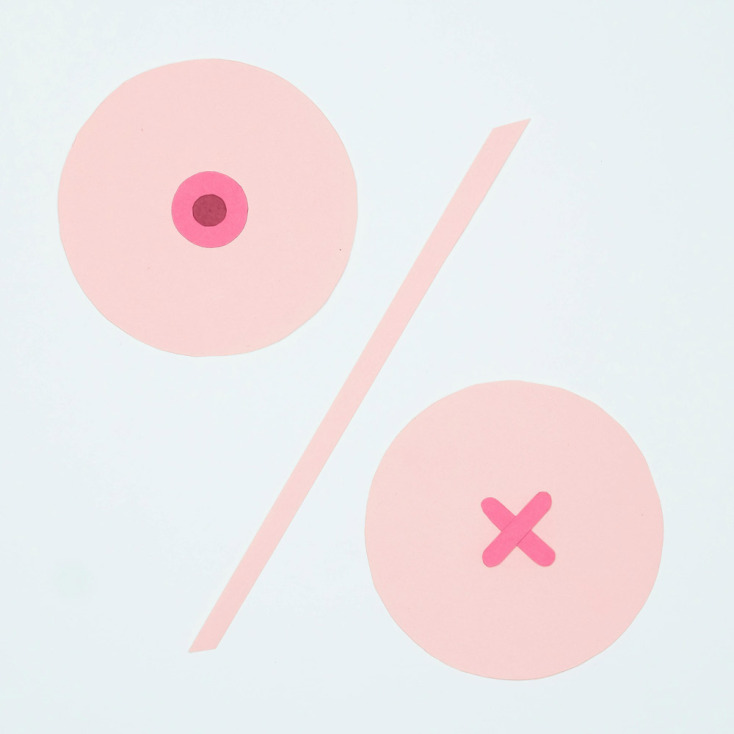 Καρκίνος του μαστού