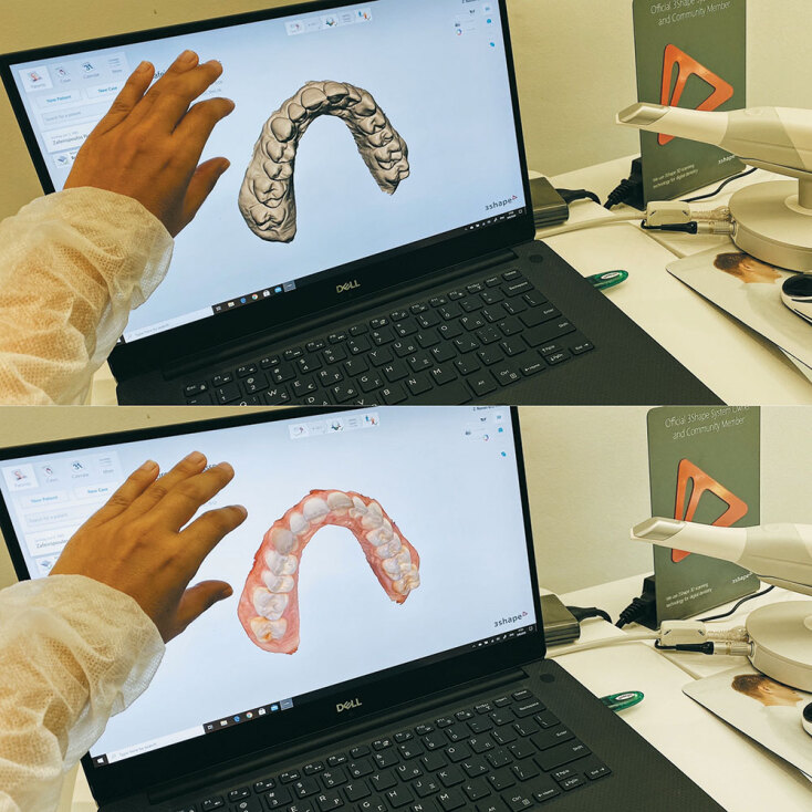 Νέες εξελίξεις στην ορθοδοντική ενηλίκων