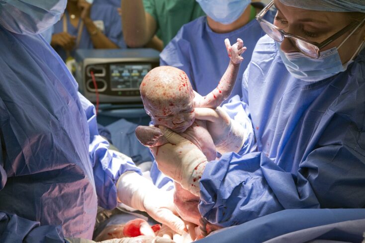 Ιατρική πρωτιά για τη Βρετανία: Η Γκρέις Ντέιβιντσον γέννησε την κόρη της, Έιμι, με μήτρα που της δώρισε η αδελφή της - Νέες προοπτικές για χιλιάδες γυναίκες