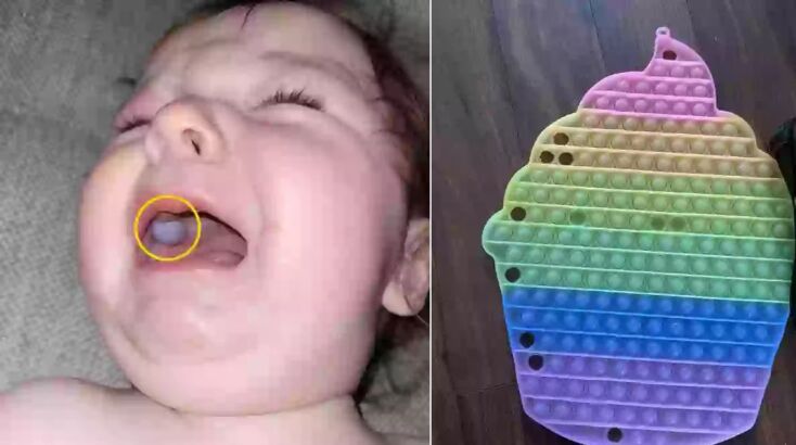 ΗΠΑ: Μια μητέρα από τη Γιούτα ανησύχησε όταν βρήκε εξόγκωμα στο στόμα του μωρού της - Οι γιατροί φοβήθηκαν όγκο - Τι συνέβαινε στην πραγματικότητα.