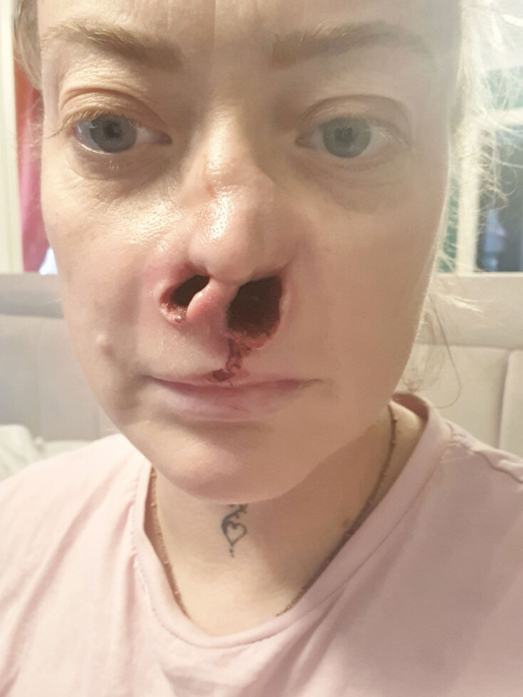 Η σημερινή κατάσταση του προσώπου της Λιάν Αμπέιανς 