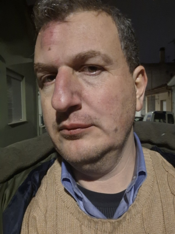 Μαγνησία: Εκδότης έπεσε θύμα άγριου ξυλοδαρμού έξω από το σπίτι του