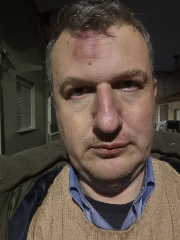 Μαγνησία: Εκδότης έπεσε θύμα άγριου ξυλοδαρμού έξω από το σπίτι του