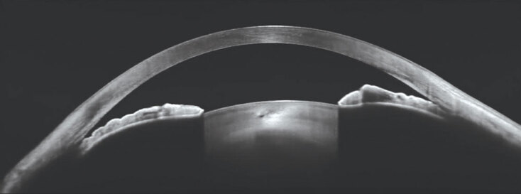 Μιχάλης Γερακίδης MD, OD, FEBO χειρούργος οφθαλμίατρος, οπτικός-οπτομέτρης