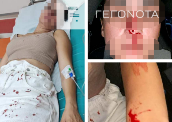 Σάλος στον Βόλο με γνωστό αθλητή που χτύπησε την πρώην σύζυγό του