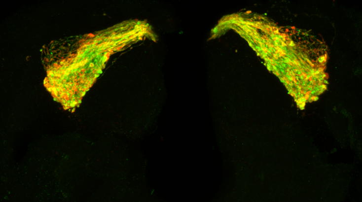 H εικόνα του εγκεφάλου μιας φρουτόμυγας ηλικίας επτά ημερών. Το πράσινο χρώμα περιγράφει τους νευρώνες, οι οποίοι αρχίζουν να διογκώνονται και να εκφυλίζονται λόγω της πρωτεΐνης Tau. Το κόκκινο χρώμα δείχνει τα σημεία, όπου η Tau συσσωρεύεται σε ομάδες κατά μήκος των νευρώνων.