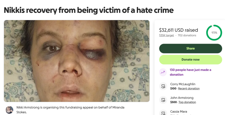 Βίαιη επίθεση σε τρανς γυναίκα στο Σιάτλ - Συνελήφθησαν τέσσερις ύποπτοι, η Νίκι Άρμστρονγκ δηλώνει πως δεν νιώθει ασφαλής στις ΗΠΑ.